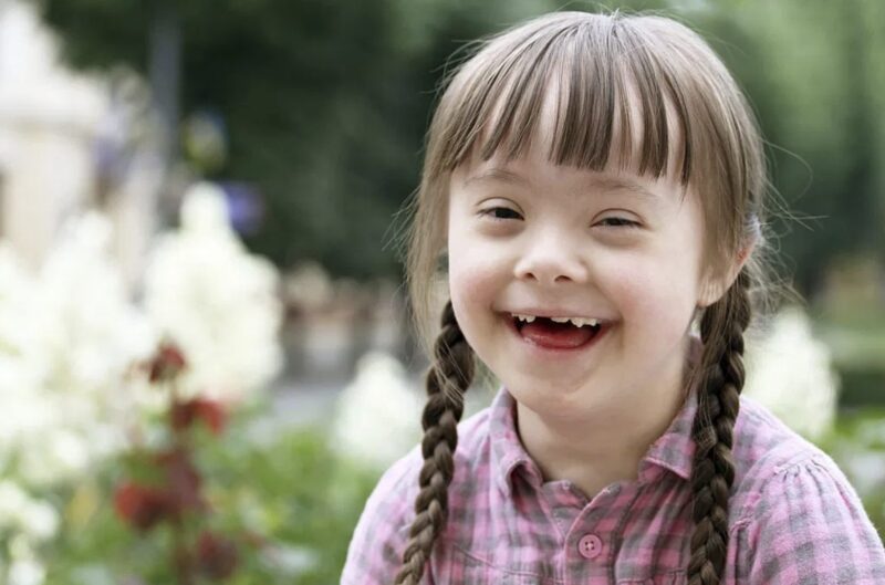 Jag adopterade en flicka med Downs syndrom som ingen ville ha. Strax efter såg jag 11 Rolls-Roycer parkera framför min veranda.